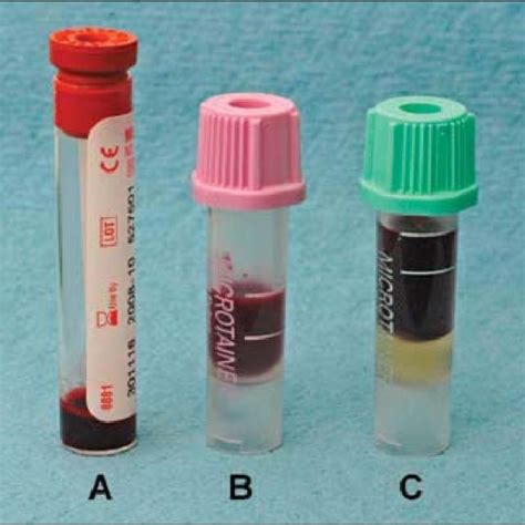 red top tubes used in serology